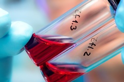 Тест на ВІЛ-інфекцію