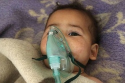 Жертвами хіматаки в Сирії стали 20 дітей