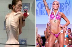 От анорексички до бодибилдера: она весила всего 25 кг, а стала спортивной чемпионкой