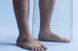 Недетская болезнь: Борьба с полиомиелитом в серии фотографий Эхтирама Джаби