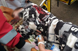 Потерпілий 14-літній хлопець