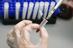 Кияни і гості столиці мають можливість безкоштовно перевіритися на наявність ВІЛ-інфекції і гепатиту