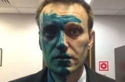Навальний жаліється, що поліція не розслідує напад на нього