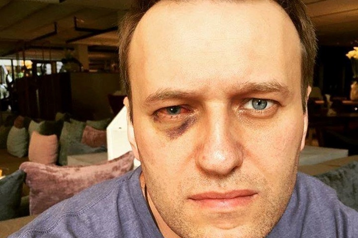 Навальному зробили операцію на оці: зір буде відновлюватися кілька місяців