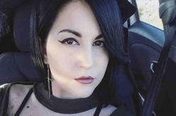 Испанка опубликовала откровенные фото, чтобы показать красоту пятнистого тела