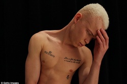 Модель-альбинос взорвал мир моды: необычный парень стал звездой подиума