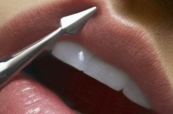 Ушивание губ: новый сумасшедший тренд набирает обороты