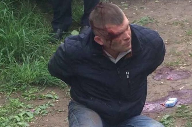 Поліція відкрила справу за фактом нападу на охоронця Яроша в Кам'янському