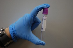  Спалах ботулізму в Україні 