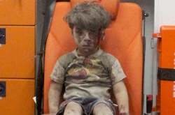 Журналистка показала, как сейчас выглядит мальчик, выживший после бомбежки в Алеппо