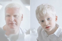 Фарфоровая красота: 13 фотографий «белоснежных» людей, которые кажутся очаровательными пришельцами