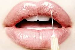 Николь Кидман и еще 10 знаменитостей, которые увеличили губы