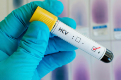 Чотирьох мешканців Запорізької області у лікарні заразили гепатитом