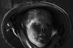 Нечеловеческая жестокость: как во Вьетнаме обливают кислотой людей, чтобы свести счёты 