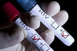 Ситуація із захворюваністю на СНІД у сучасній Росії і більшій частині колишніх радянських республік катастрофічна - ООН