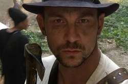 И для звезд вакцины нет: Валерия Харчишна покусала собака