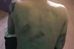 Лутковська оприлюднила фото одного з арештантів Одеського СІЗО зі слідами кийка на спині