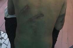 У Мін’юсті відреагували на побиття в Одеському СІЗО: Ніхто не скаржився