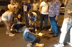 Постраждалого у ДТП з сином Шуфрича готують до другої операції