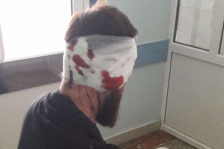 У Харкові серед білого дня побили депутата облради (фото)