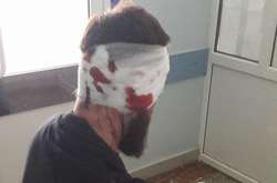 Побитий депутат Дмитро Булах