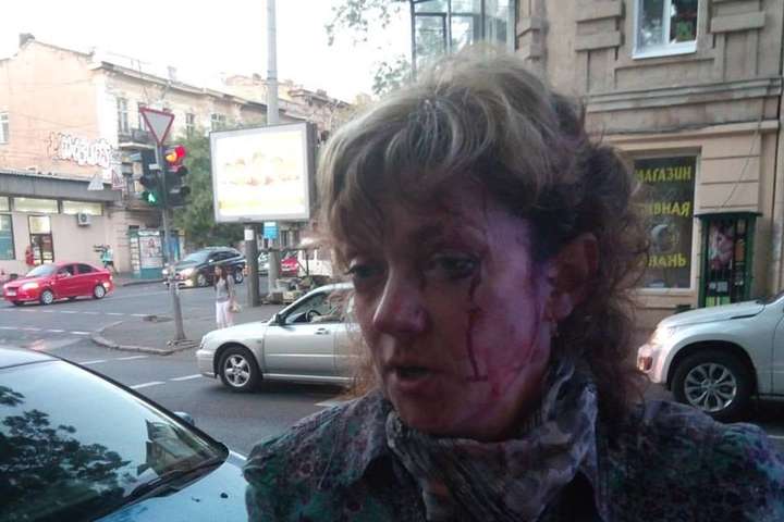 В центрі Одеси побили заступницю глави обласного «Народного Руху України»