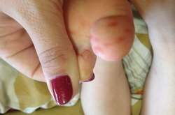 В Киеве родители детей забили тревогу из-за вируса в детсаду