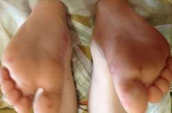 Батьки маленьких киян б'ють на сполох через вірус у дитячому садочку