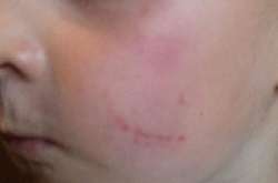 Скандал в детсаду под Киевом: заведующая избила мальчика (фото)