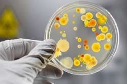 Львів’янин помер від лептоспірозу після невдалого самолікування