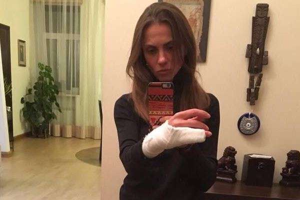 Київські поліцейські зламали руку жінці: з'явилося відео