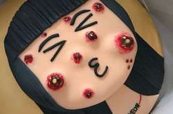 В Сети набирают популярность торты с «прыщами»