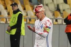 Домагою Віді у цьому протистоянні розбили голову