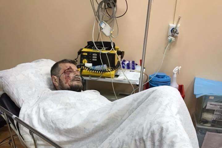 Лікарі заявили, що у Мосійчука багато осколкових поранень: його ще оперують
