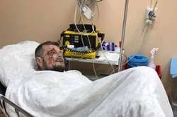 Теракт у Києві. Повинен бути удар у відповідь