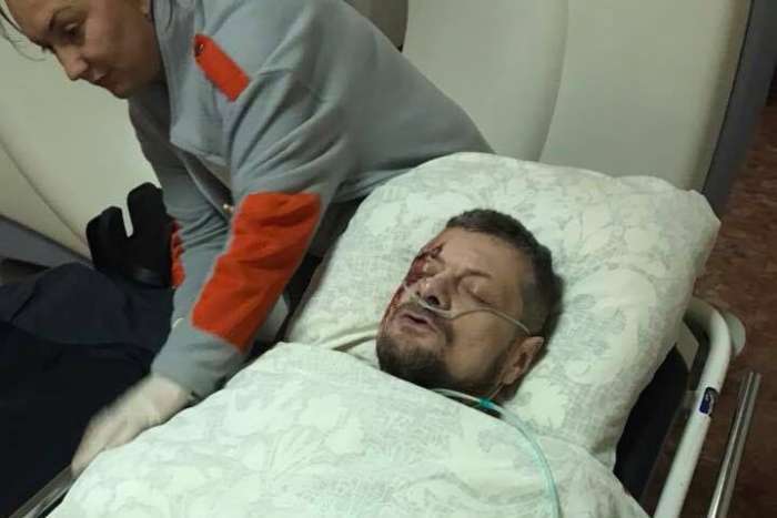 Лікар: Мосійчук перебуває в тяжкому стані