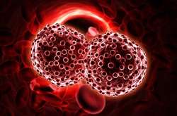 Лікування раку крові в Україні віднині сплачуватиме держава