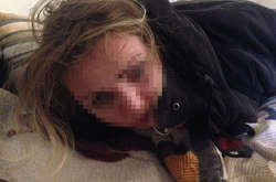 Под Киевом похитители неделю держали в подвале женщину-врача