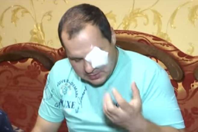 На Вінниччині жінка вибила око поліцейському, який захищав її від побоїв