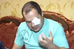 На Вінниччині жінка вибила око поліцейському, який захищав її від побоїв