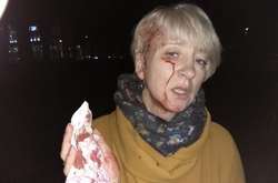 Жестокое нападение на судью в Полтаве: полиция ищет очевидцев