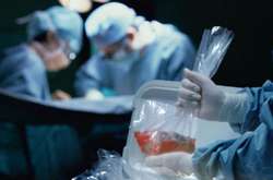 Трансплантація органів