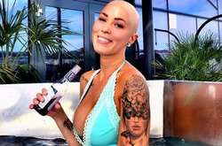 Из гадкого утёнка в лебедя: как лысая девушка перестала стесняться и превратилась в звезду глянцевых журналов