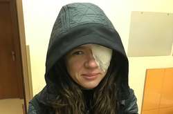 Популярной украинской певице прооперировали глаз