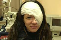 Руслана впервые объяснила причины операции на глазе