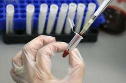 Масове зараження гепатитом у Миколаєві: поліція відкрила кримінальну справу