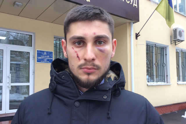 ЗМІ: Напад на адвоката: київська прокуратура покриває «земельного рейдера» Попова?