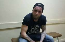 Поліція розслідує побиття помічника депутата Криворізької міськради