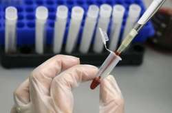 У Миколаєві на гепатит захворіли вже понад 60 людей