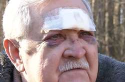 На Київщині родичі побили колишнього працівника МВС та заснули на місці злочину